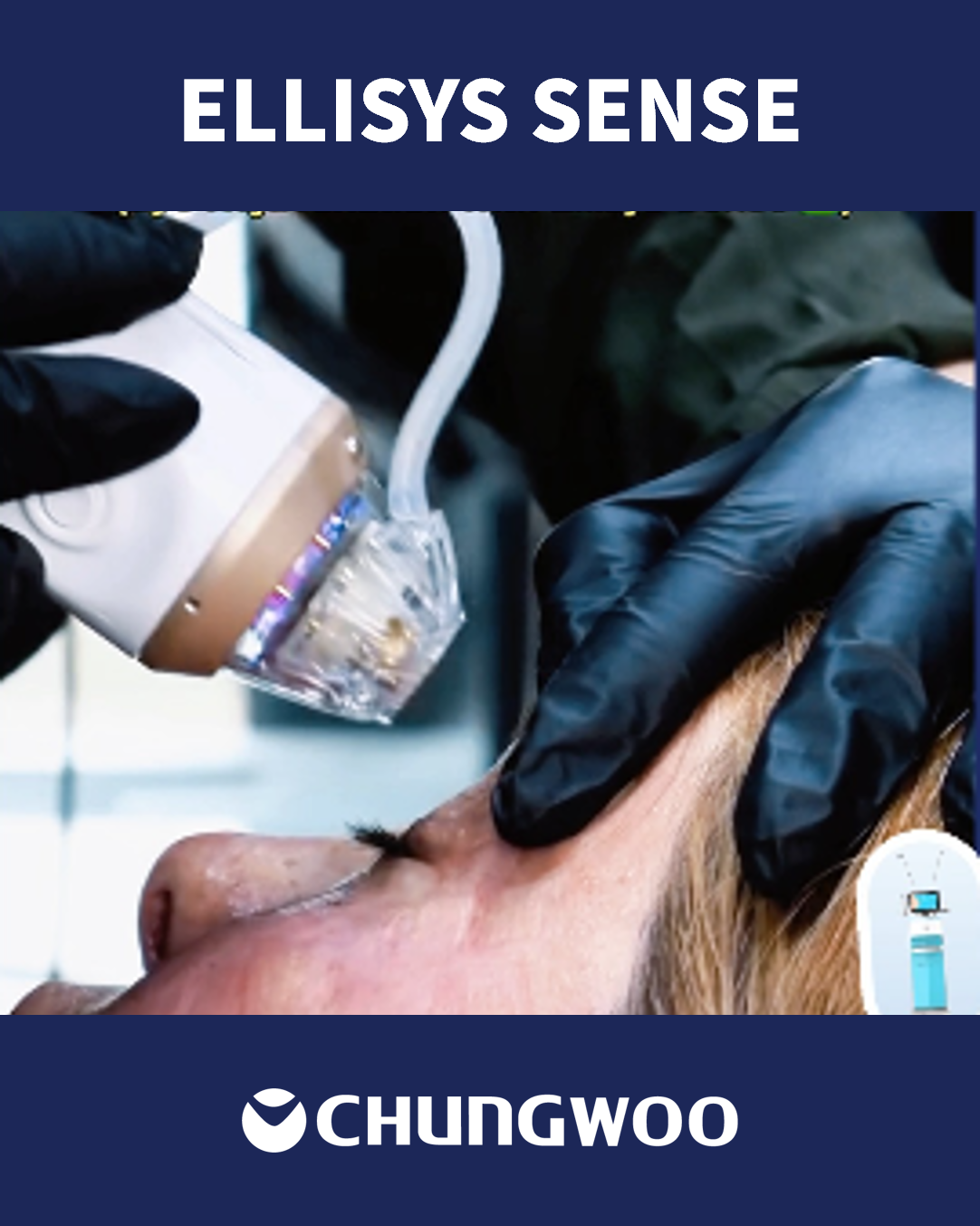 ELLISYS SENSE